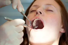 A woman having her teeth cleaned