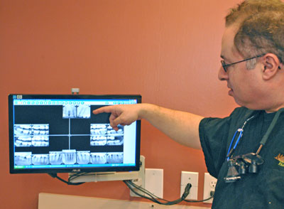 Doctor pointing to x-rays