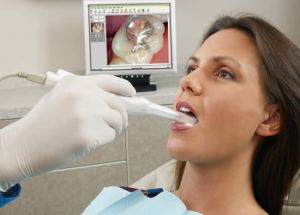 Doctor using an intraoral camera to look at a patient's teeth